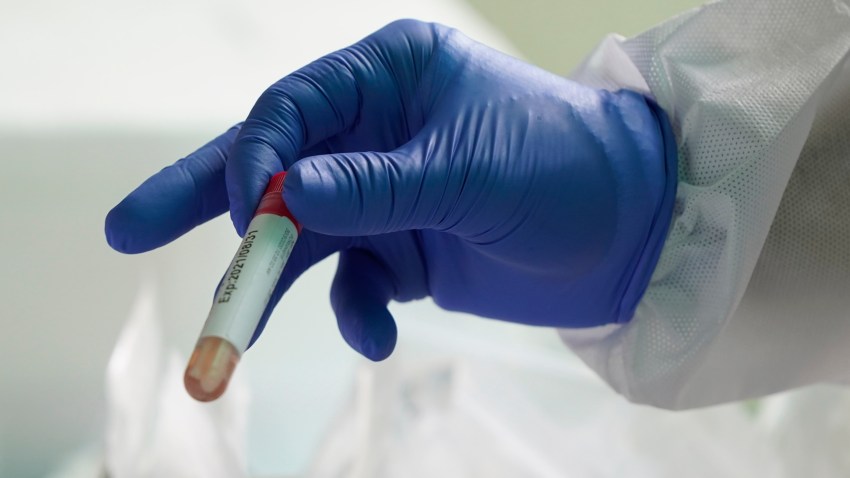A health worker holds a testing tube after conducing at a drive-through COVID-19 test at KPJ Damansara Specialist Hospital, in Petaling Jaya, Malaysia