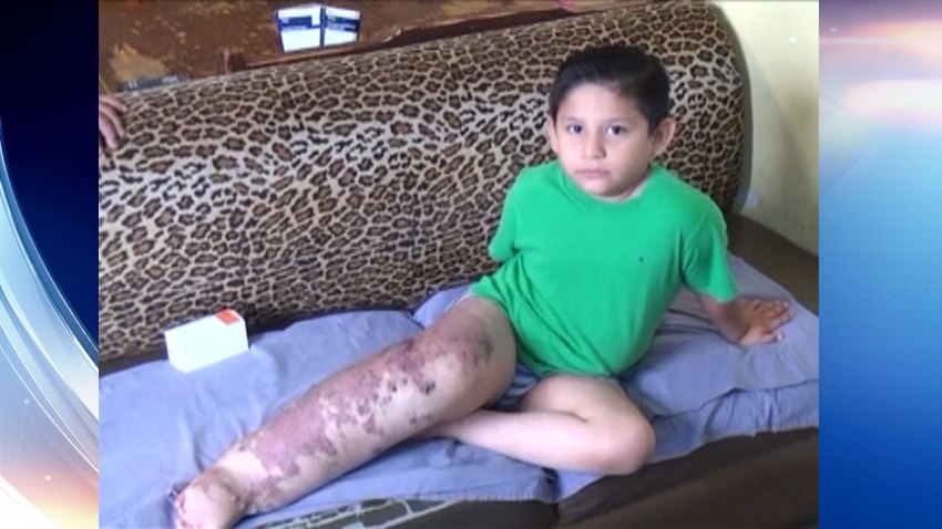 TLMD-Osiel-Francisco-