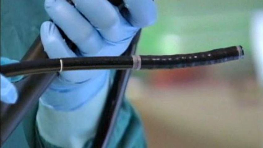 TLMD-nuevo-metodo-para-medir-riesgo-de-cancer-de-colon