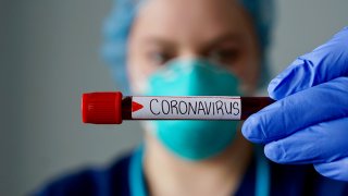 Un enfermero enseñando un tubo de sangre que dice coronavirus.