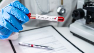 prueba de sangre positivo coronavirus