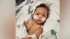 Bebé de seis meses lucha por su vida tras cirugía a corazón abierto