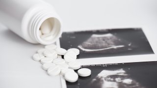 Foto de un pote de pastillas con foto de un sonograma mostrando un feto.
