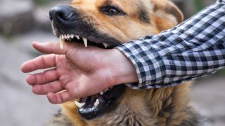 Foto solo ilustrativa sobre un perro furioso y una persona con la mano en la boca del animal.