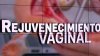 Reportaje Especial: “Rejuvenecimiento Vaginal”