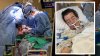 Pulmón artificial e implantes de seno: la innovadora operación para salvar a hombre al borde de la muerte