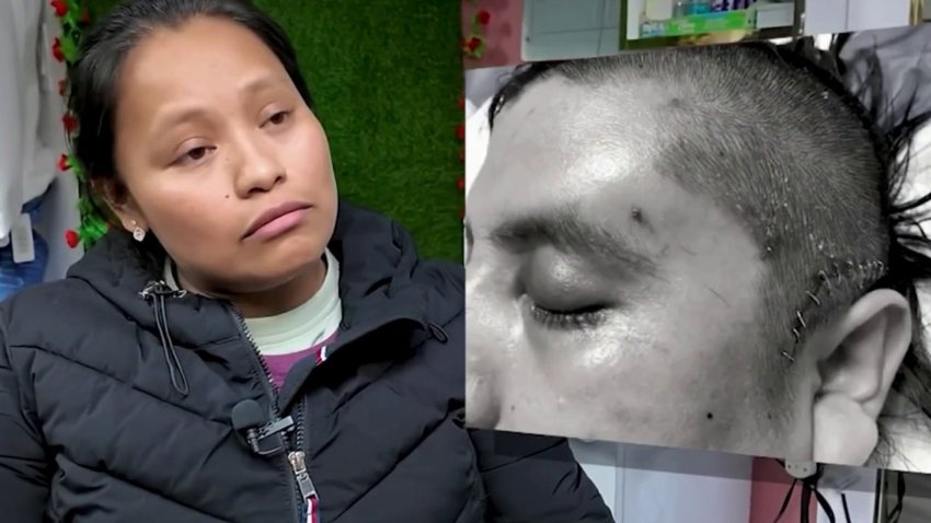 Muere padre mexicano tras años en coma por ataque en 2017