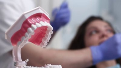 ¿Planificas ponerte implantes dentales? Esto es lo que necesitas saber para hacerlo