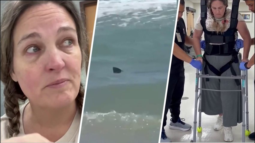 Mujer que perdió pantorrilla al ser atacada por tiburón en la Isla del Padre Sur da primeros pasos