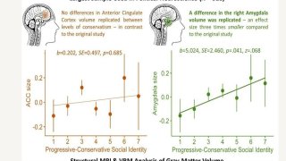 ¿Tienen la misma estructura cerebral los votantes de izquierdas y de derechas?