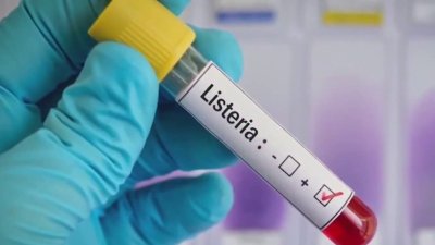 Alerta por brote de listeria: ¿cuáles son los síntomas?