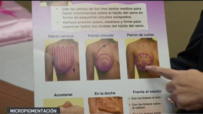 Micropigmentación: Procedimiento para mujeres que han perdido senos a causa del cáncer